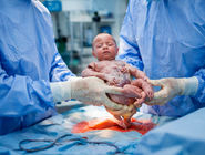 زایمان سزارین در چند هفتگی انجام می‌شود؟