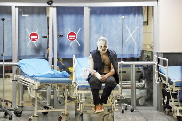 جان‌‏های سوخته فقیر/گفت‌وگو با قربانیان و متخصصان سوختگی درباره هزینه بالای درمان، کمبود امکانات در بیمارستان‌ها و نوع مواجهه مردم